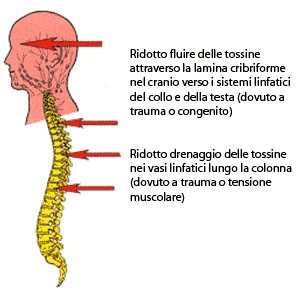 Sindrome fatica cronica